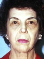 Facelift
