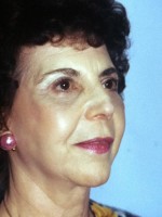 Facelift
