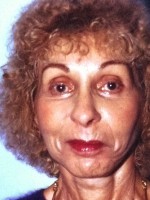 Facelift