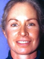 Blepharoplasty
